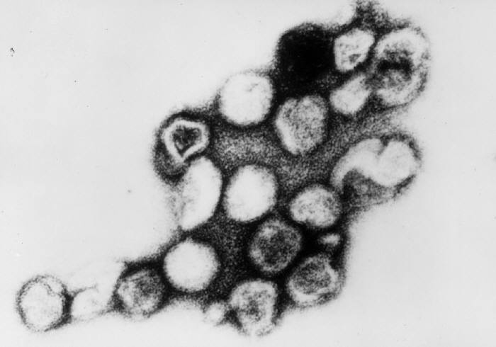 Petite histoire de Rubella Virus, RuV à l’heure de la Covid-19