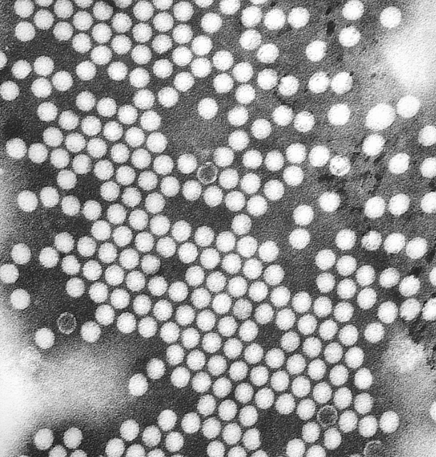 Détection d’un poliovirus dérivé d’une souche vaccinale de type 2 (PVDV2) dans les eaux usées à Londres
