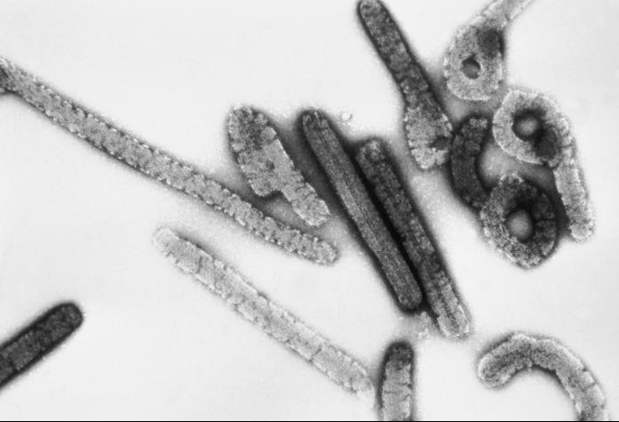 Virus de Marburg : il est urgent de contenir ce proche cousin d’Ebola