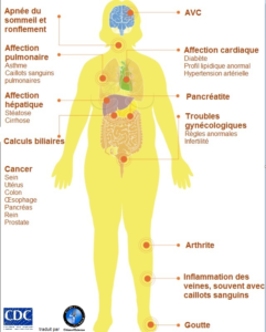 Complications de l'obésité CDC